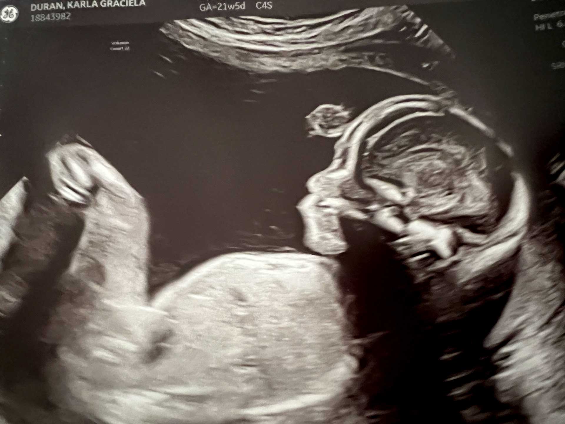 The original ultrasound photograph of Gael before his arrival.